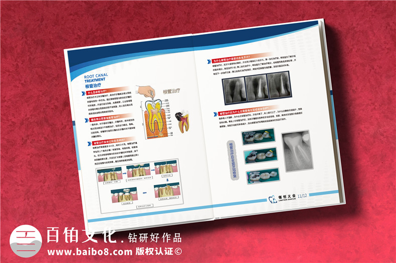 義齒畫冊怎么做-精裝高檔的義齒制作公司產(chǎn)品宣傳冊